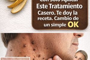Cáscara de plátano y verrugas: qué dice realmente la ciencia sobre este popular remedio casero
