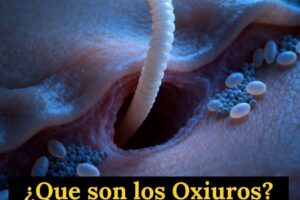 Oxiuros: el parásito intestinal que aparece principalmente durante la noche y afecta con frecuencia a los niños