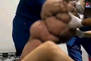 ¿Dormir con una mano bajo el cuerpo puede provocar graves deformaciones? La verdad detrás de la imagen viral