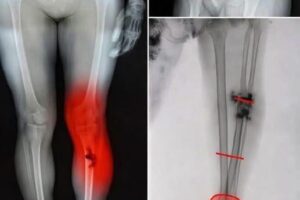 Dolor en piernas y circulación: ¿tiene relación con el COVID-19?