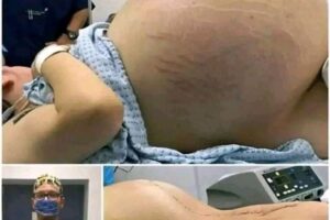 ¿Por qué algunas mujeres tienen un abdomen extremadamente grande durante el embarazo? Las causas médicas que debes conocer