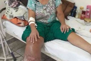 Estas son las posibles consecuencias de dormir con medias demasiado apretadas durante toda la noche